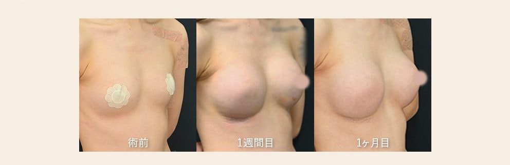 最短ダウンタイム