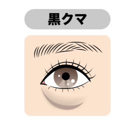 黒クマの原因
