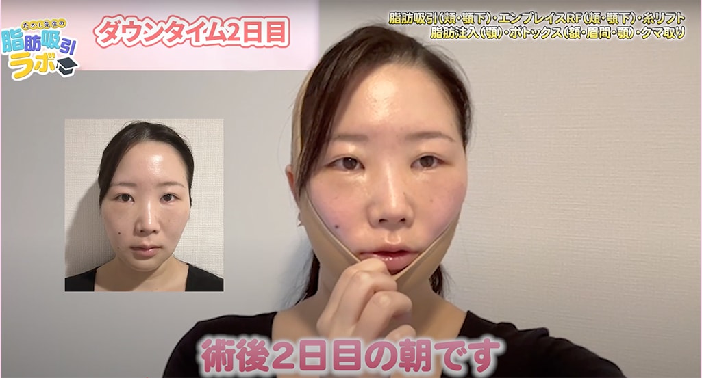 ダウンタイム2日目の朝