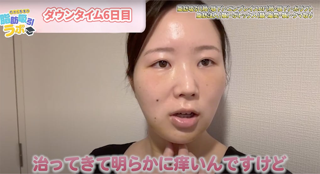 ダウンタイム6日目の夜