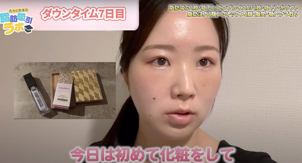ダウンタイム7日目の夜