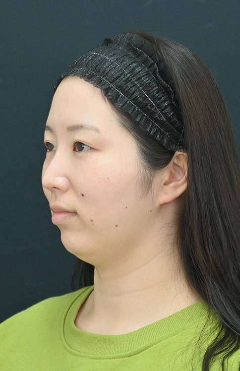 小顔になりたい方