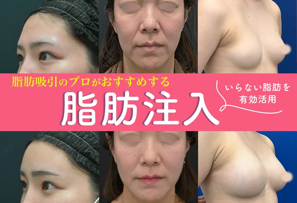 脂肪は財産です！実は捨てるのもったいない！？