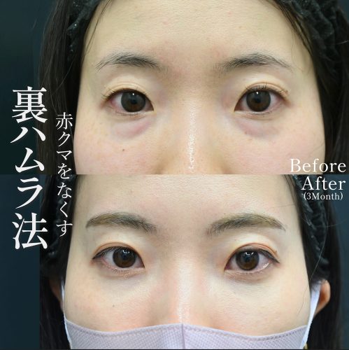 複数のクマが混在する混合タイプについて