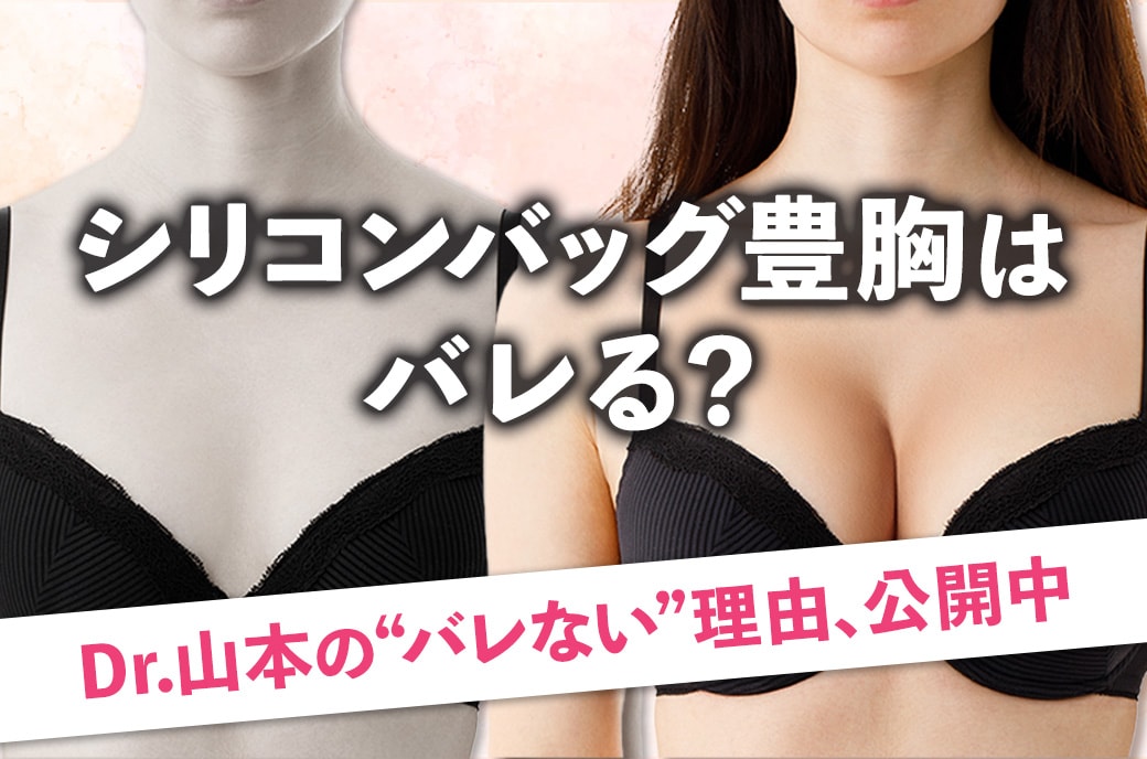 シリコンバッグ豊胸はバレる？自然な仕上がりにこだわるあなたへ【湘南美容クリニック名古屋院】