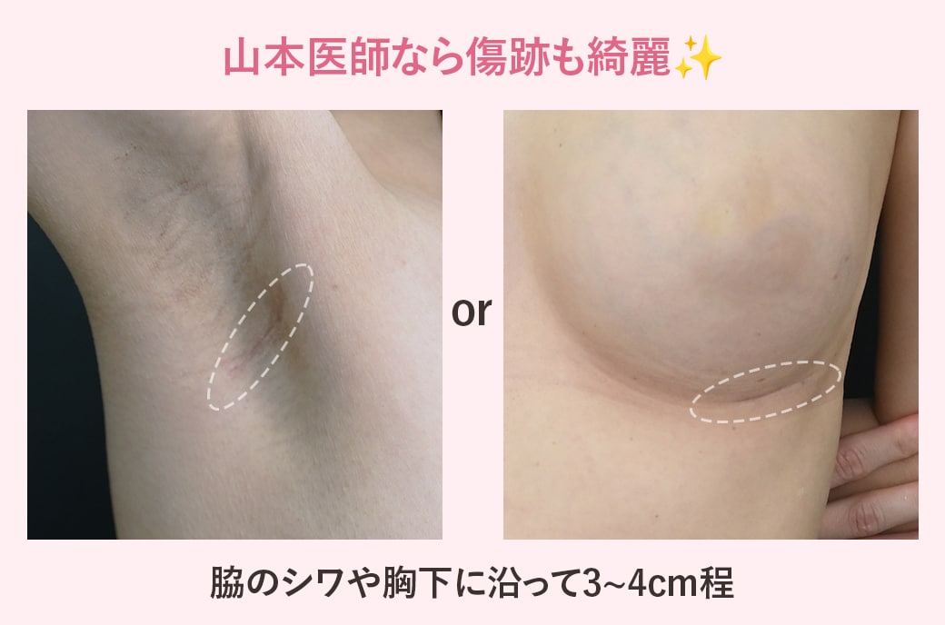 傷跡は目立ちますか？<br />
