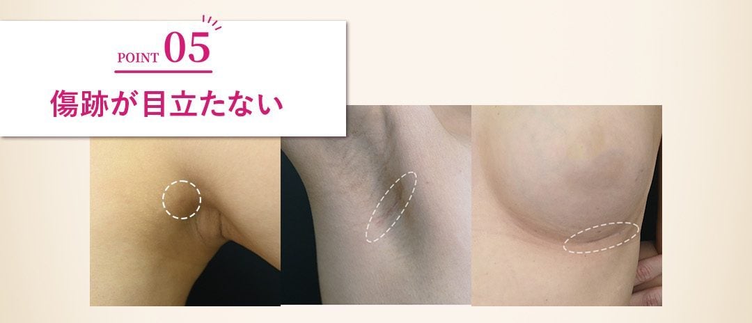 縫合が得意で傷跡が目立たない<br />
