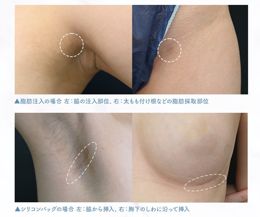 縫合が得意で傷跡が目立たない<br />
