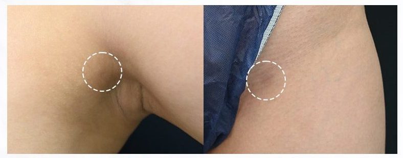縫合が得意で傷跡が目立たない<br />
