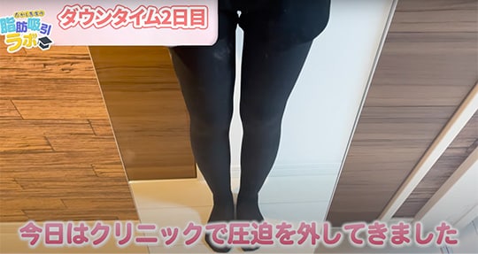 術後2日目
