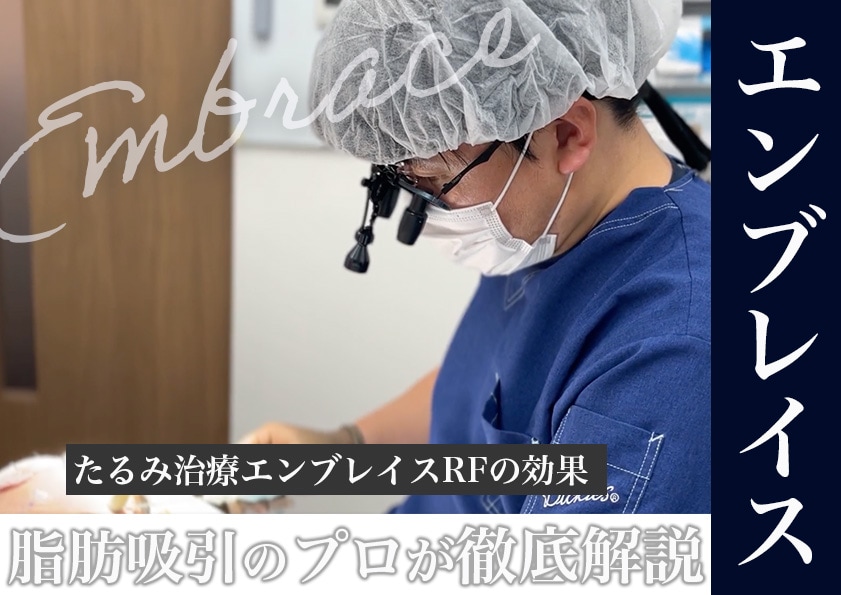 たるみ治療エンブレイスRFの効果を脂肪吸引の名医が徹底解説！