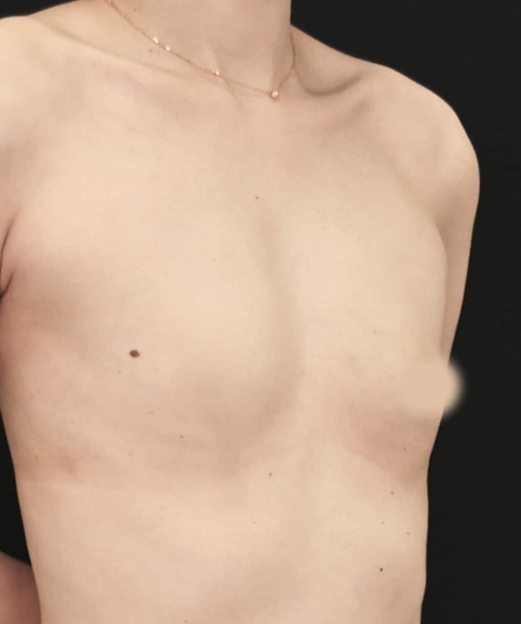 確実・大幅なバストアップ♪