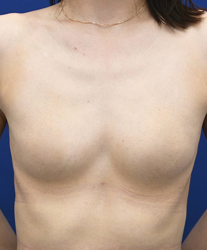 自然なバストアップと柔らかさ★