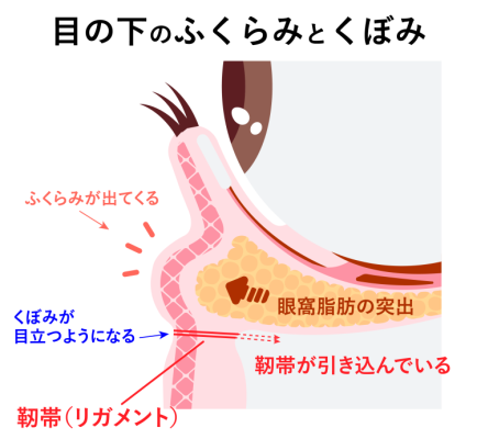 なぜ目の下に「ふくらみ」と「くぼみ」ができるのか?