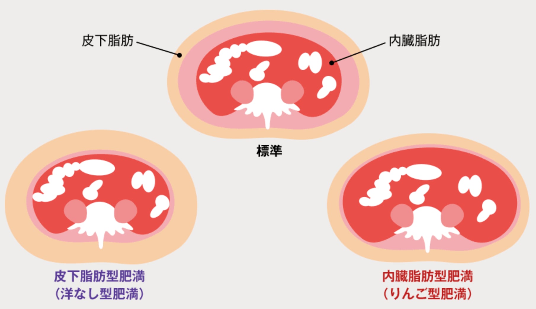 ②内臓脂肪が多い方（特にお腹周り） 