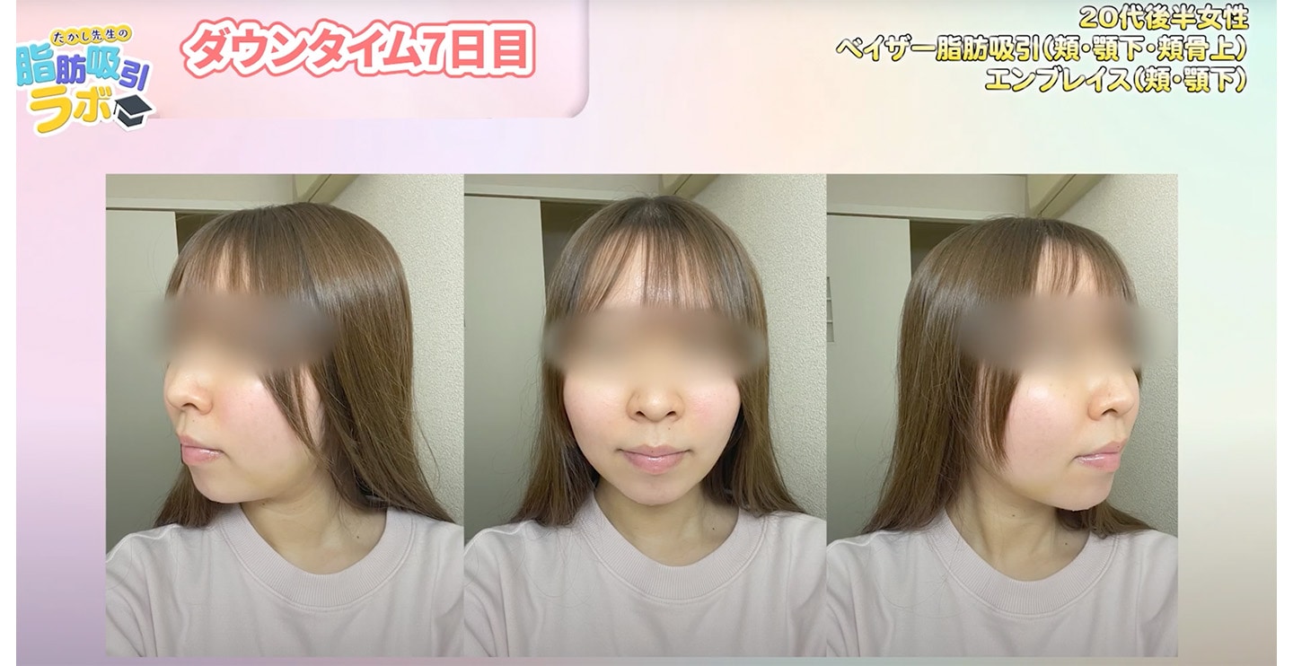 【ダウンタイム７日目】