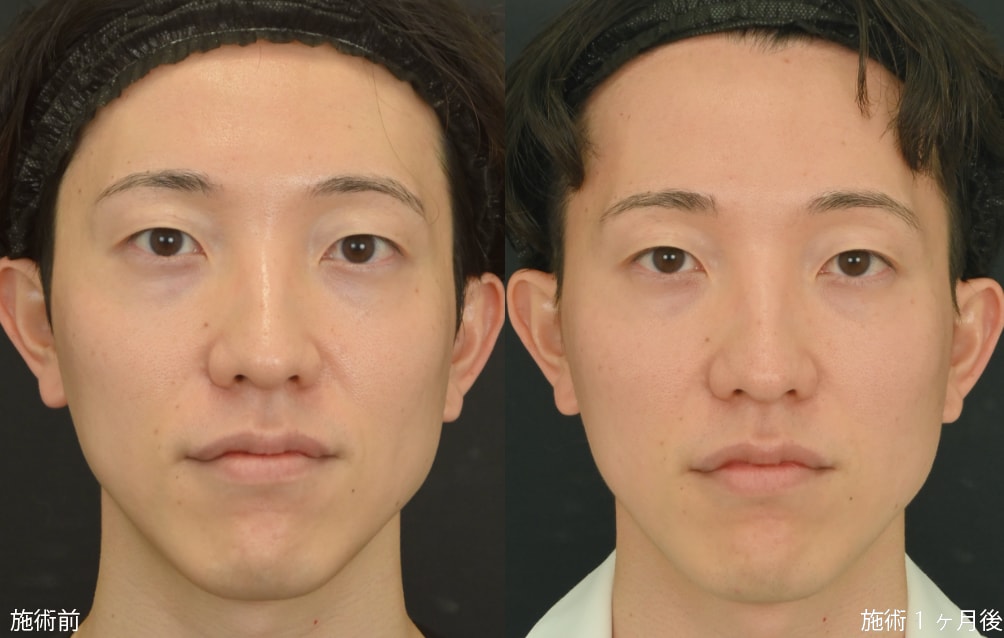 スタッフも多数受けています♪