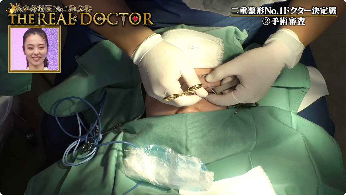 ① 組織を傷つけない「繊細な手技」