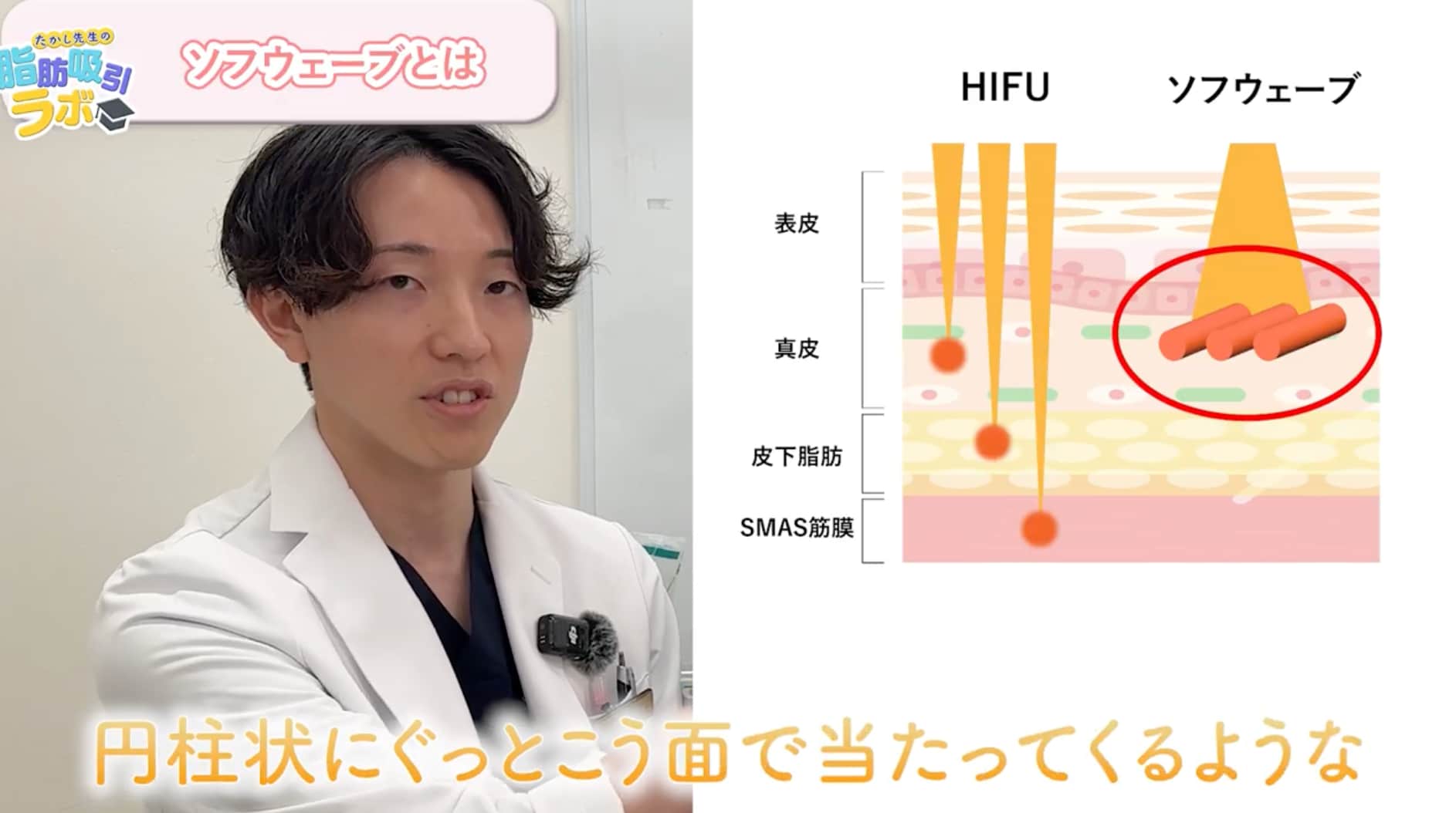 ソフウェーブとは