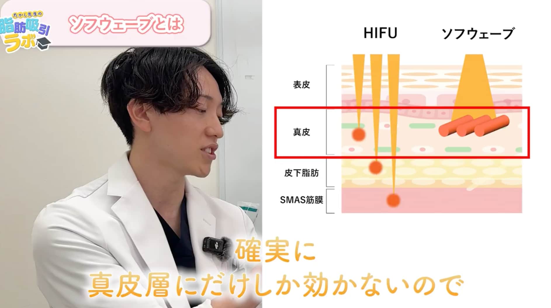 ソフウェーブの特徴とリスク