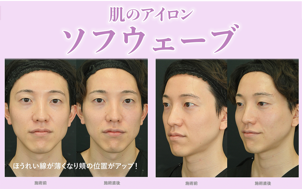 津田先生の効果実感