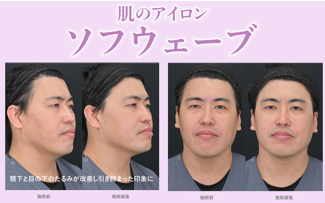 山本先生の効果実感