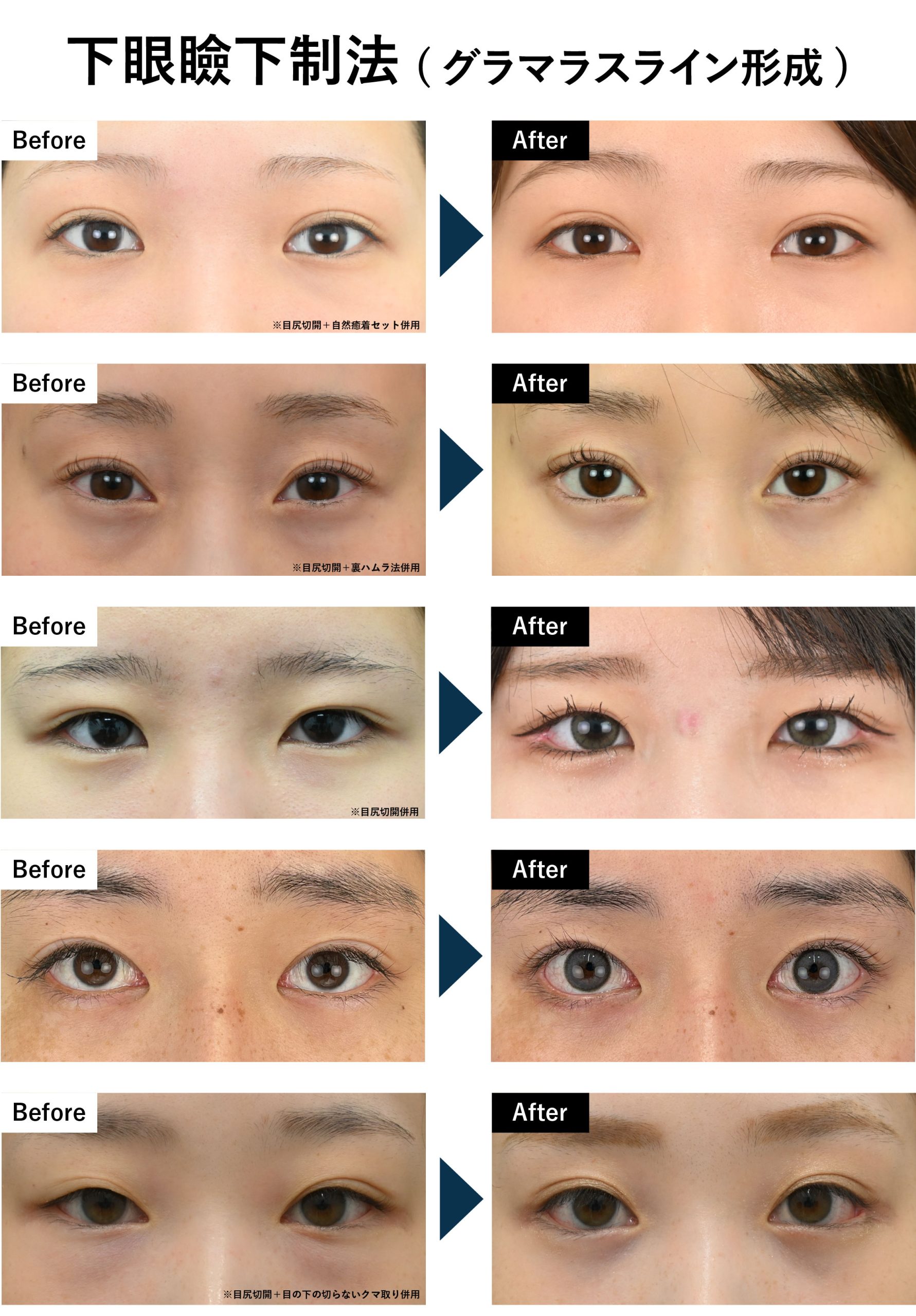 まずは症例写真をご確認ください