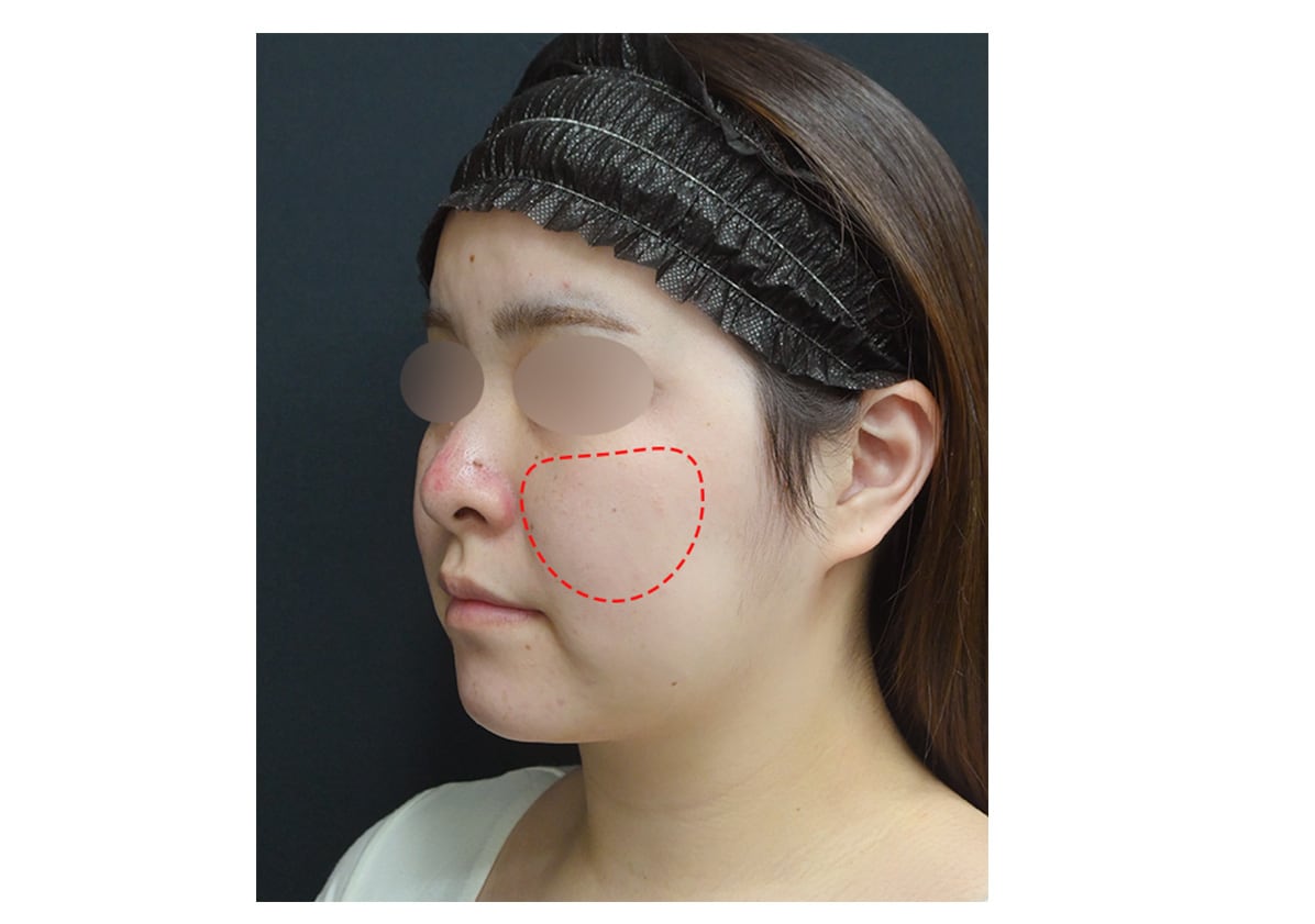 メーラーファットの解説