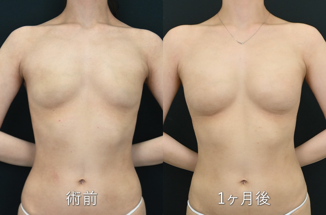 ビフォーアフター