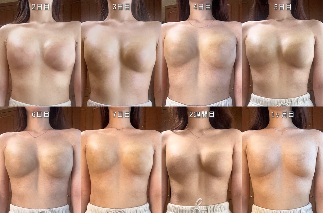 ダウンタイム1ヶ月間