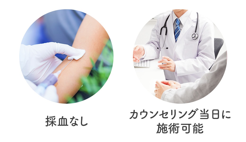 事前採血なしで、当日施術が可能！