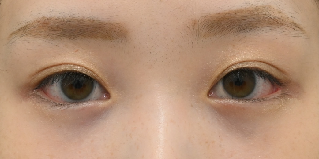 理想のかわいい目元になるフルセット