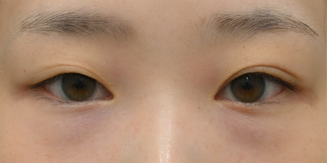 理想のかわいい目元になるフルセット