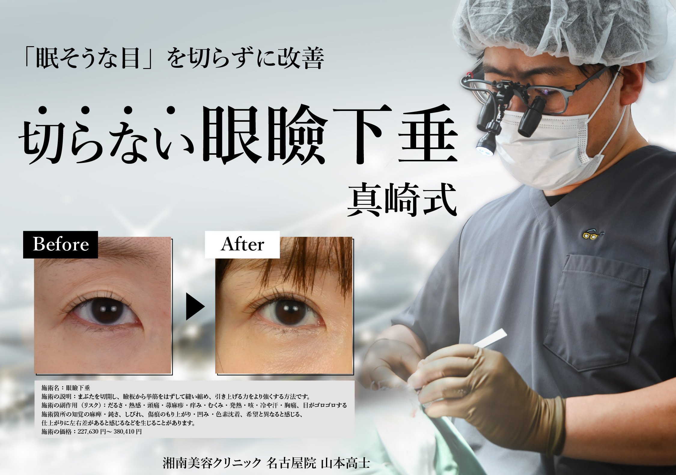 【名古屋】「まぶたが重い」…それ眼瞼下垂かも？切らない眼瞼下垂(真崎式)｜湘南美容クリニック名古屋院