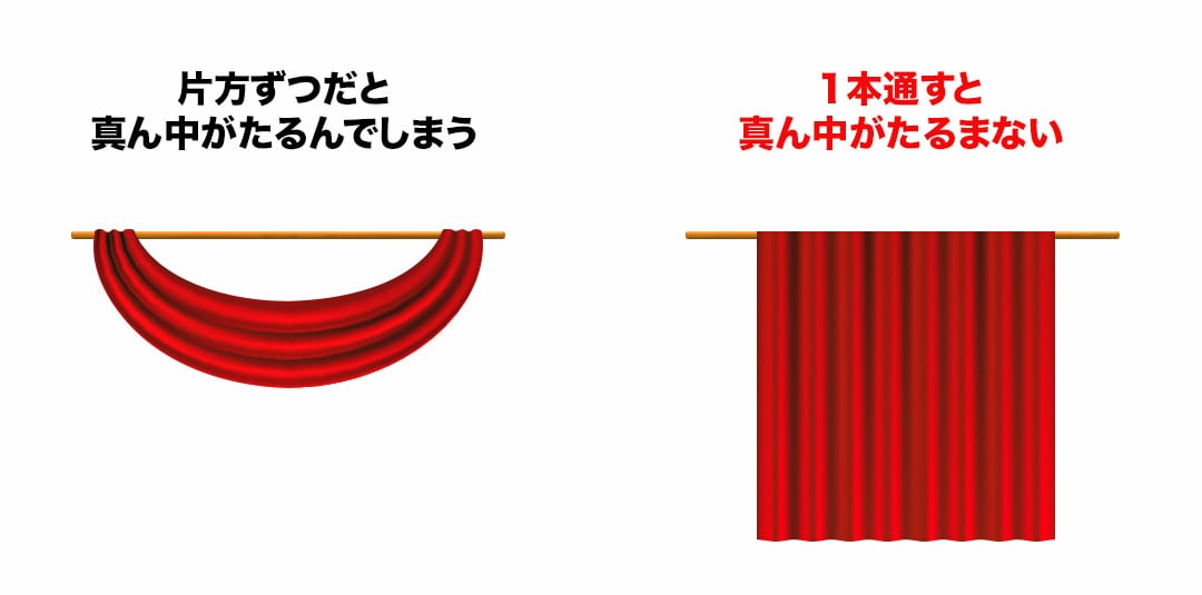 顎下専用の糸リフト