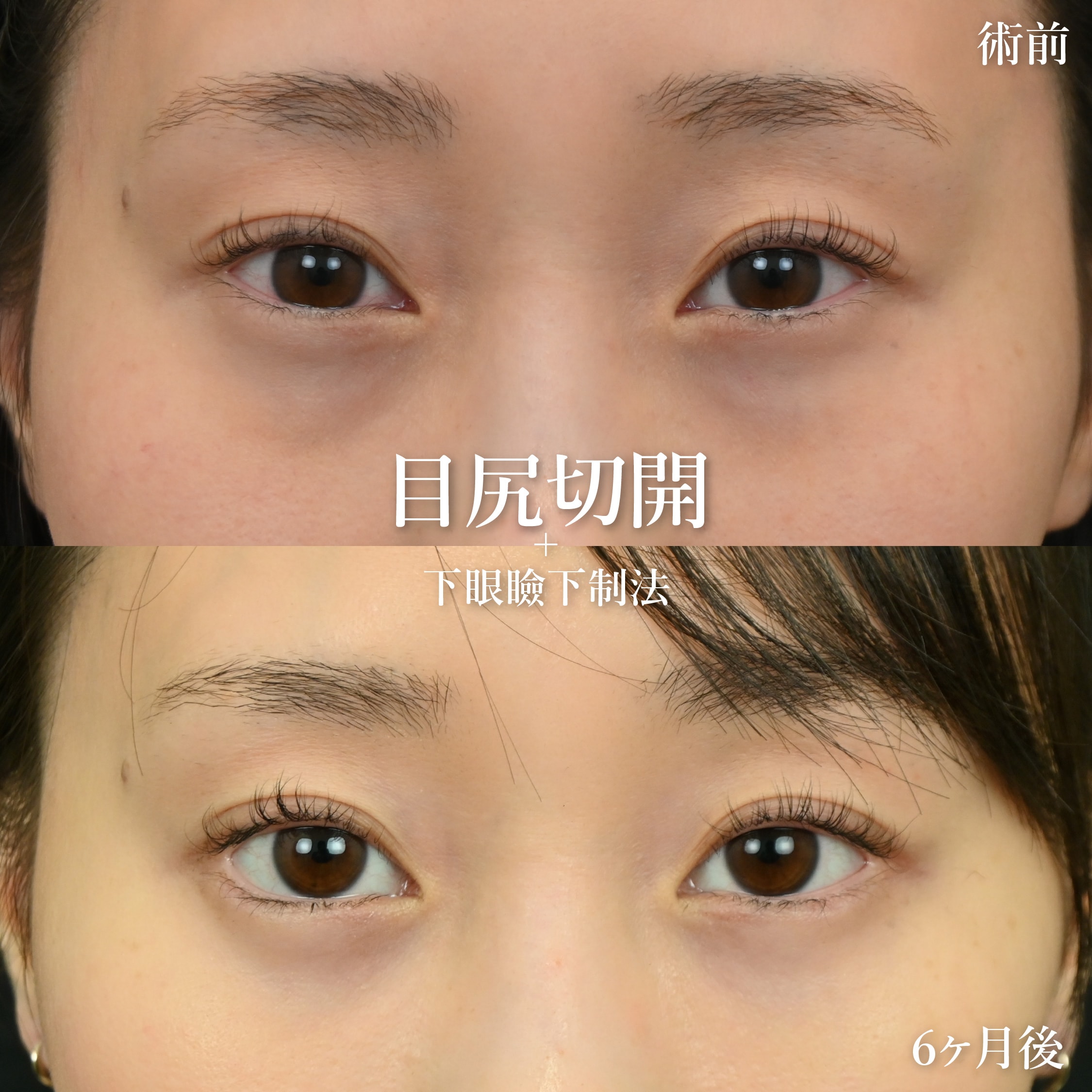 ツリ目やキツい印象を「優しい雰囲気」へ