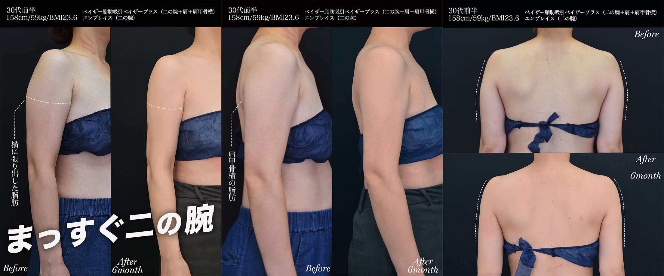 30代のモニター