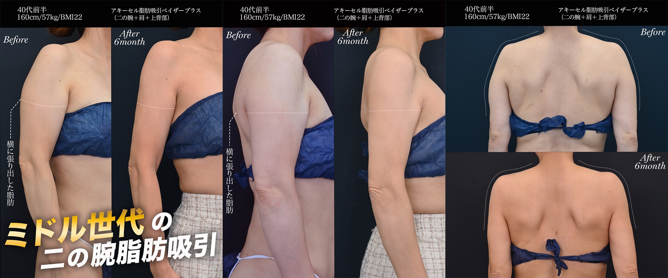 40代のモニター　