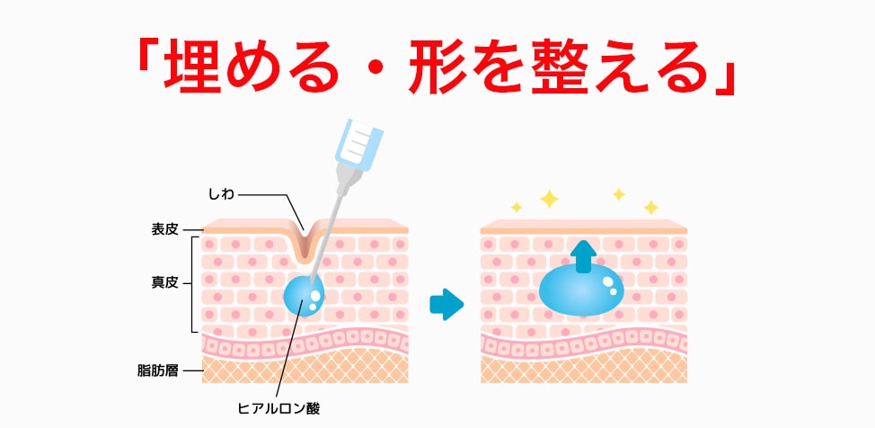 ヒアルロン酸の役割