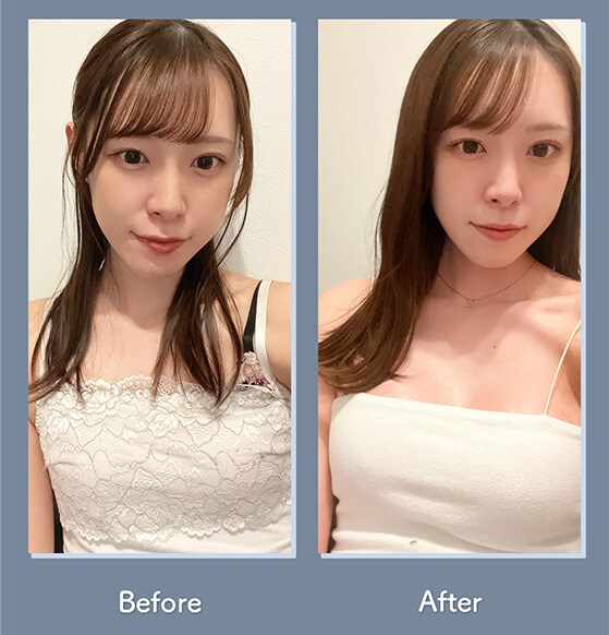 コンプレックスが解消されて、洋服選びが楽しくなりました★