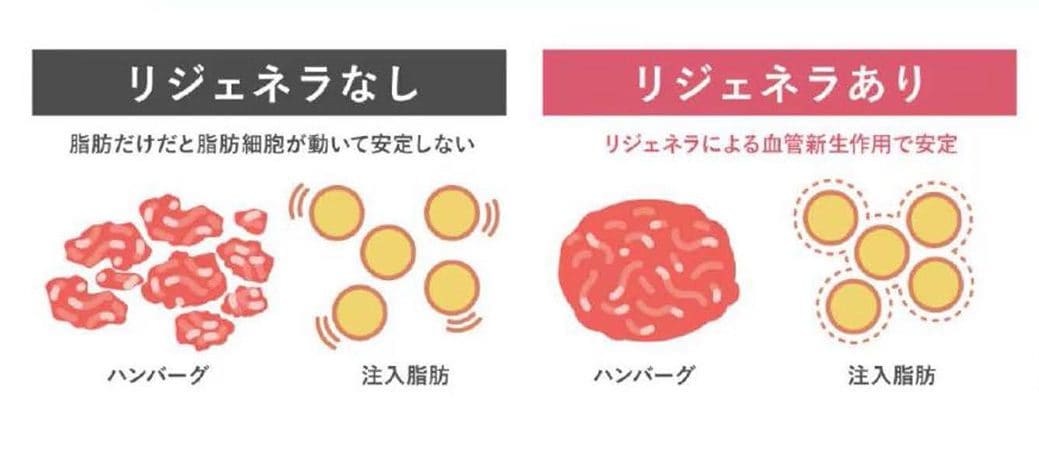 自己細胞の力で「生き残る脂肪」へ