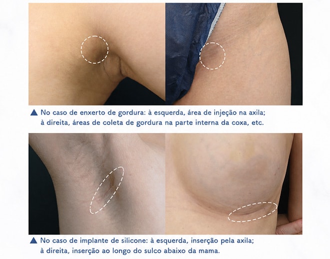 Habilidoso em suturas, resultando em cicatrizes discretas.