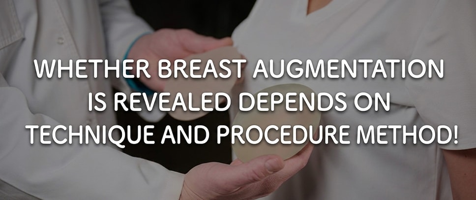 Will silicone breast implants be noticeable?