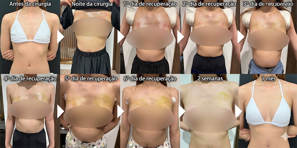 Tempo de inatividade