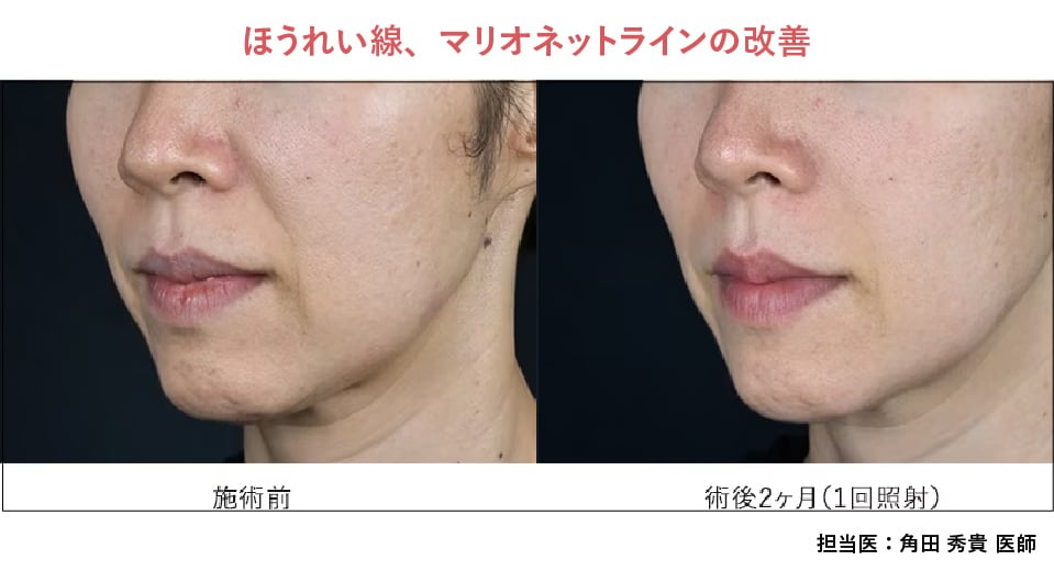 症例紹介