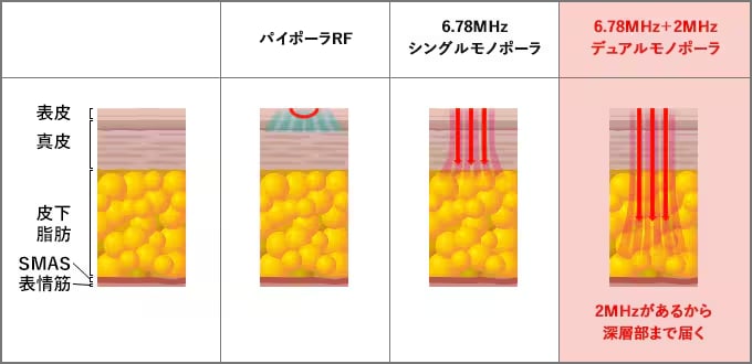 世界初のデュアル周波数で深層まで均一アプローチ