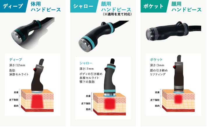 糸リフトや切開など、痛い治療やダウンタイムは避けたい