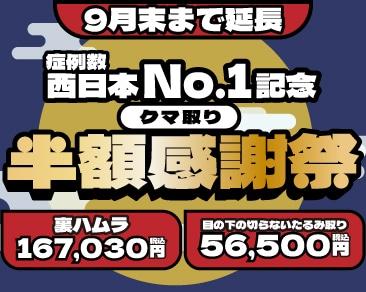 【9月末までの大感謝祭】クマ取り半額キャンペーン