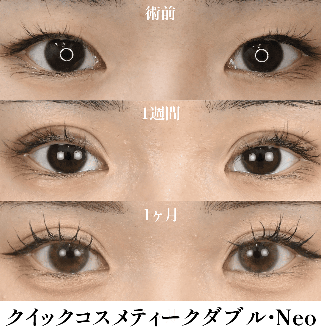 美しい症例