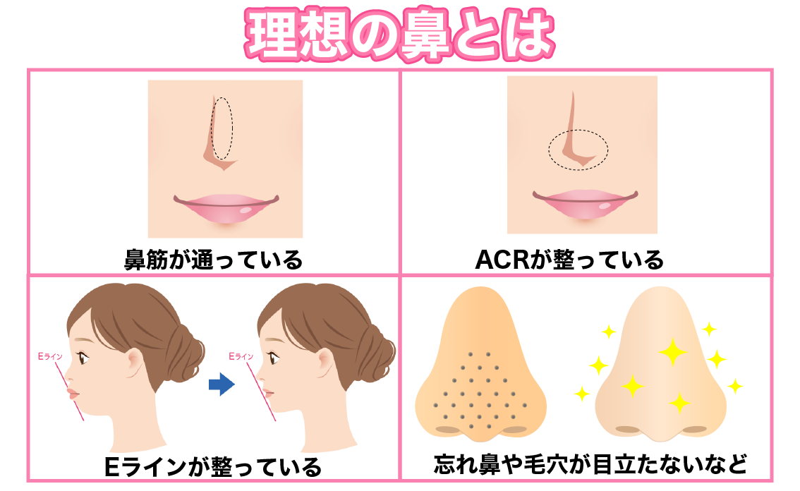一般的に美しい鼻とはどんな鼻か
